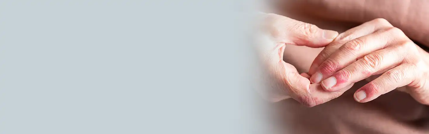 Eczema treatment
