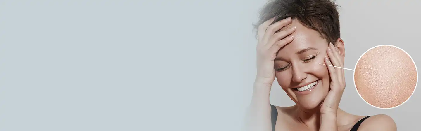 Skin Resurfacing Treatment