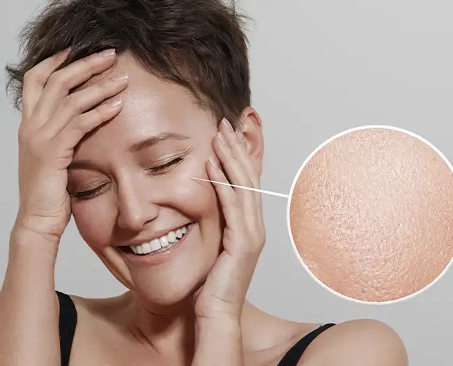Skin Resurfacing Treatment