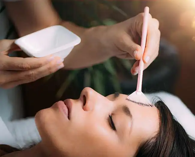 Chemical Peel